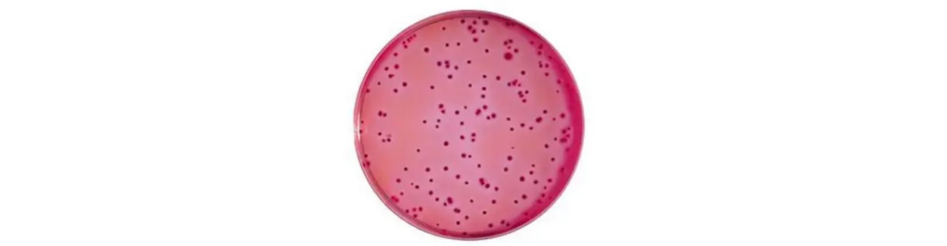 Enterobacteriaceae Aranması ve Sayımı
