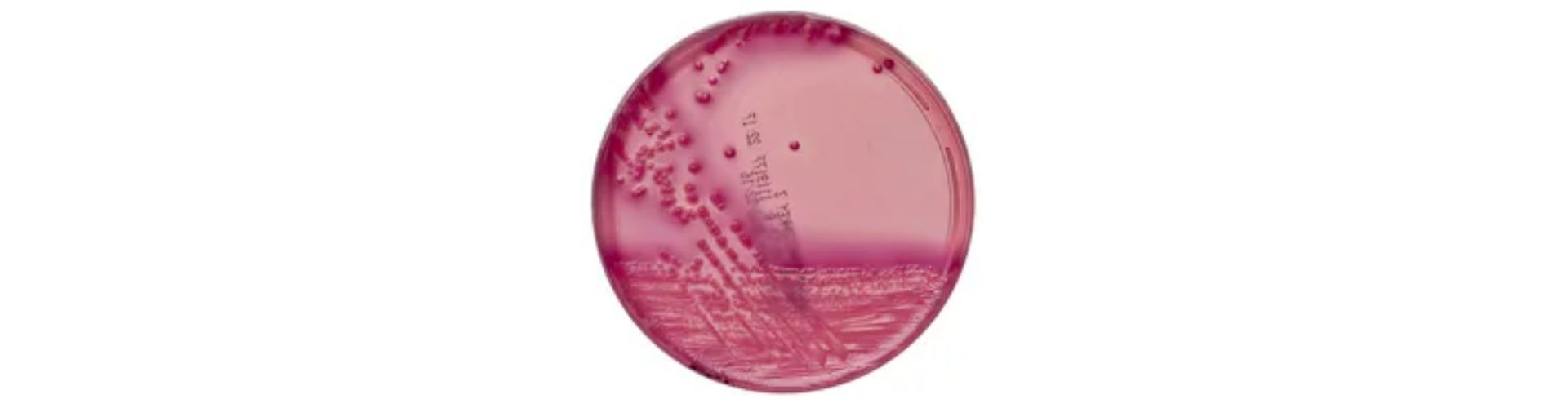 Escherichia coli