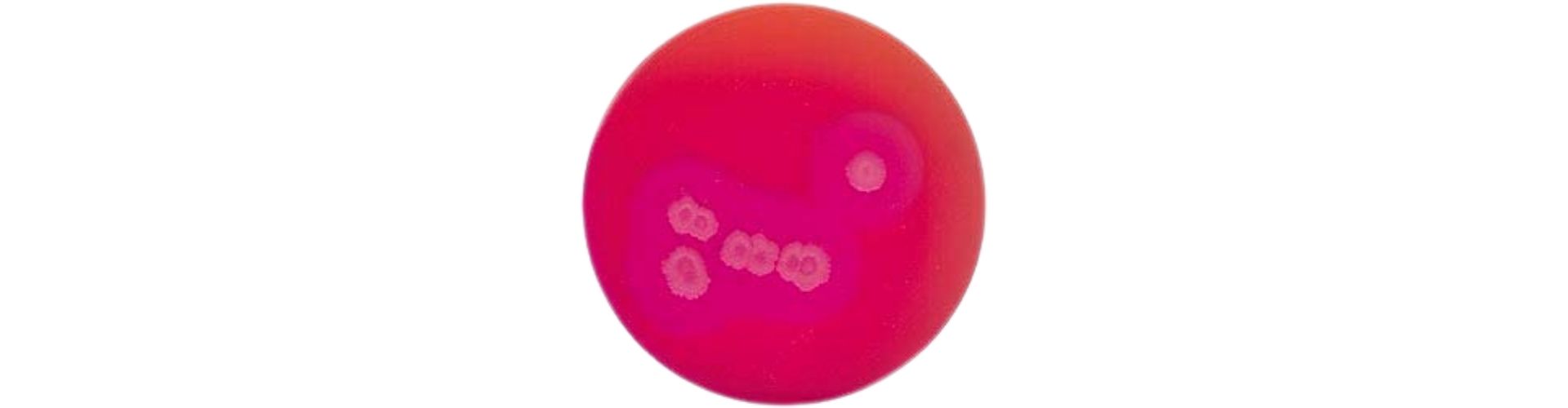 Bacillus cereus Aranması