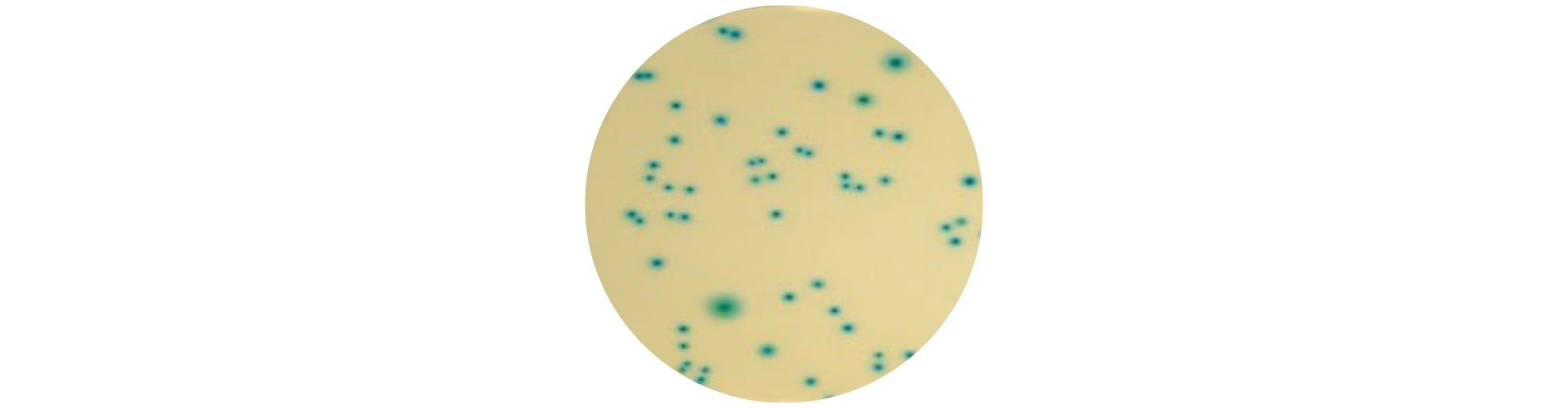 Escherichia coli O157